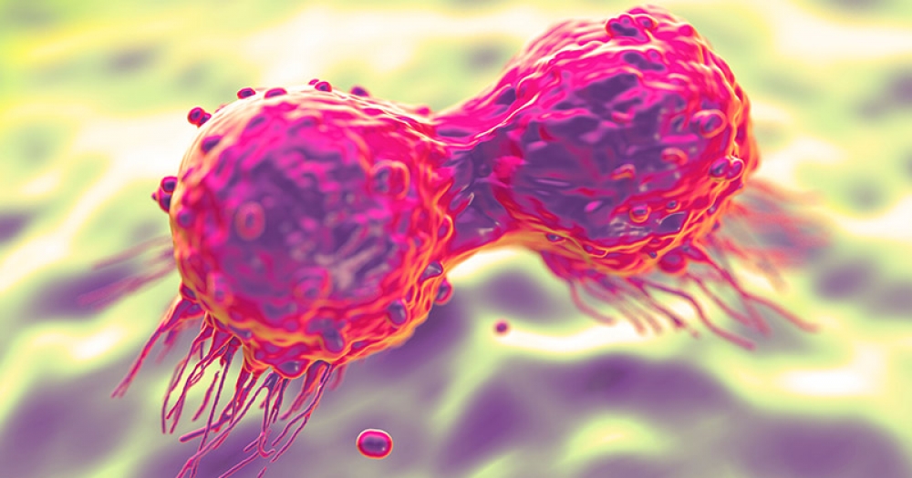 תא סרטן השד