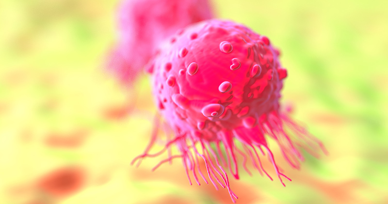 תא סרטן השד