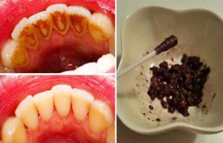 הלבנת שיניים וריח טוב מהפה, קיראו וגלו כמה זה פשוט