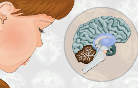 אוטיזם, תגלית מטלטלת: רקמות המוח ספוגות במתכת רעילה