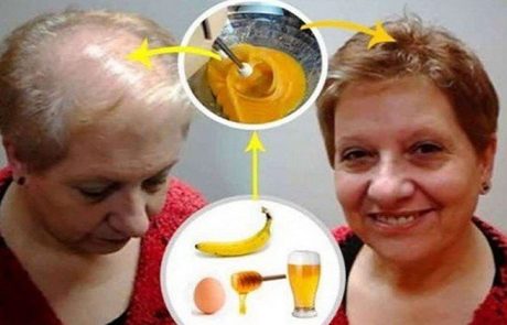 המתכון הטוב ביותר להצמחת שיער מחדש שמשאיר את הרופאים עם פה פעור