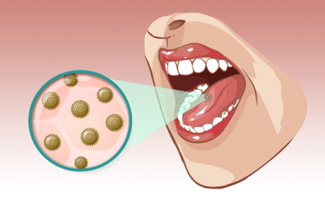 7 דרכים יעילות וטבעיות לניקוי חיידקים מהפה