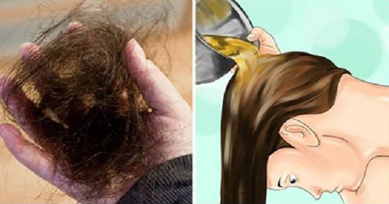 5 הסיבות השכיחות לנשירת שיער בקרב נשים
